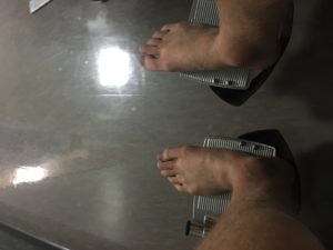 jason barefoot wheelchair marina del rey